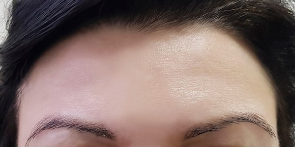 After botox procedure