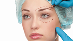 What is Blepharoplasty?