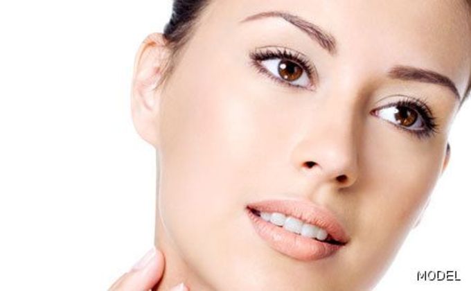 Otoplasty Case