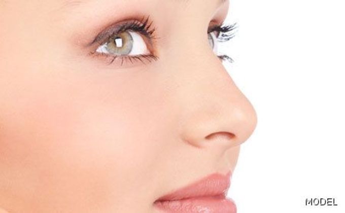 Rhinoplasty Cases