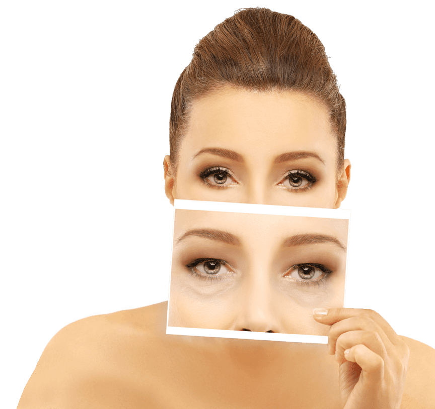 Woman showing the results of her blepharoplasty