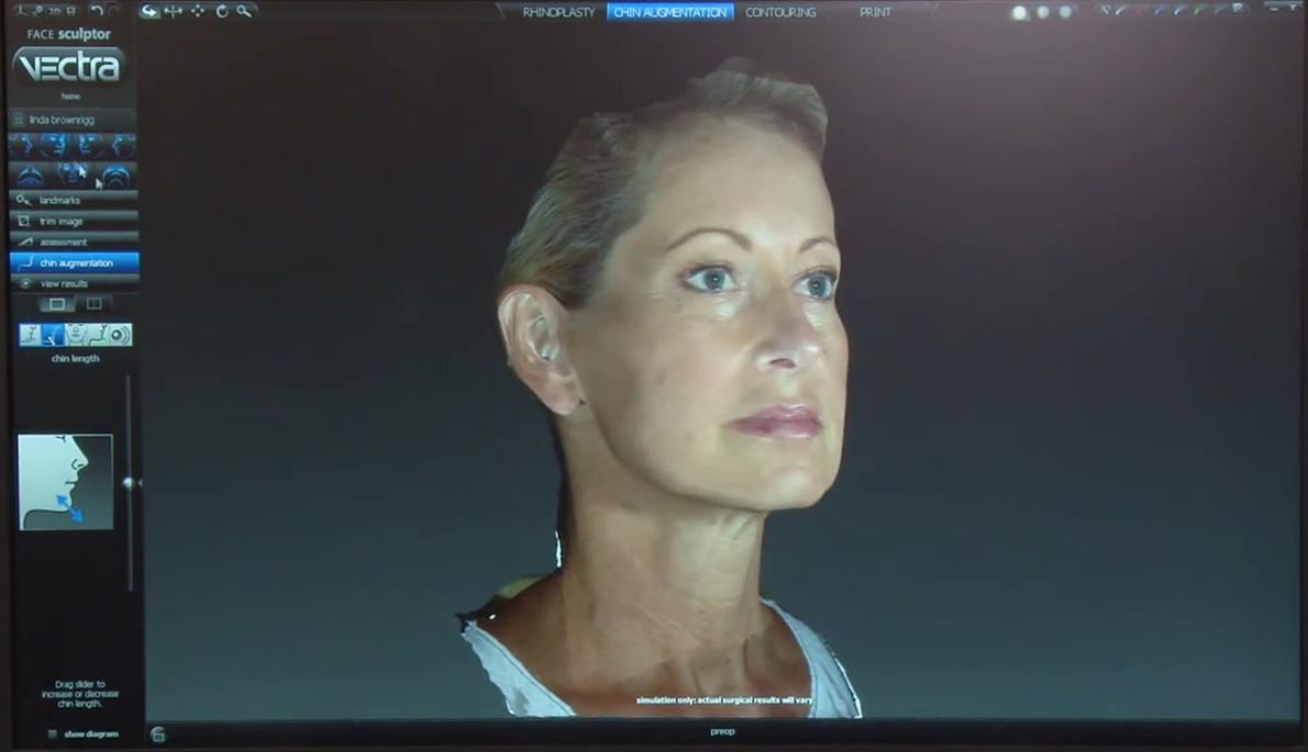 3D Vectra Imaging