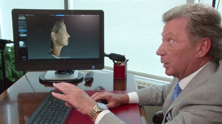 What is Rhinoplasty?